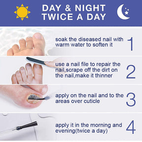 Dr.Kondo Nail Fungal Treatment Toe Nail Fungus Removal